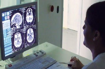 Hospital Regional recebe novos equipamentos de imagem