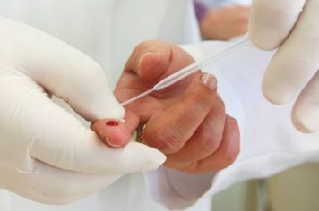 Prefeitura de Itapetininga realiza Campanha “Fique Sabendo HIV” com testes rápidos