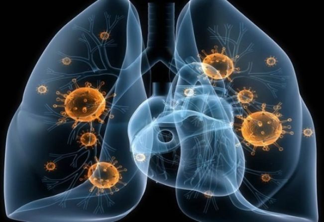Itapetininga inicia Campanha “Fique Sabendo Tuberculose 2024” com busca ativa e oferta de exame